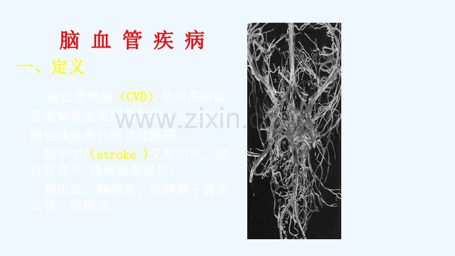 急性脑血管病急救护理.ppt_第3页