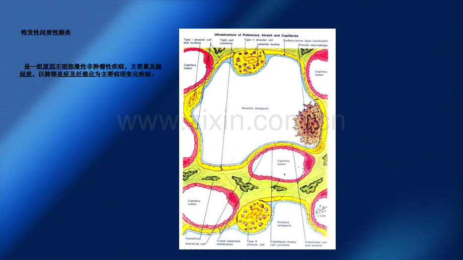 特发性间质性肺炎病理特征及分类.ppt_第3页