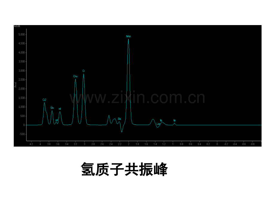 脑外DWI、MRS临床及原理.ppt_第3页