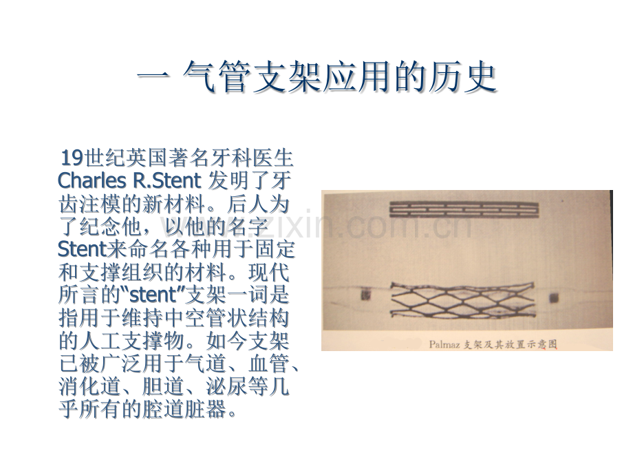 气管、支气管支架置入临床应用.ppt_第2页