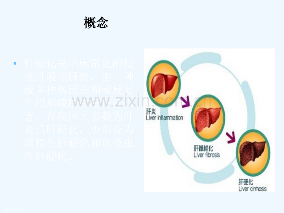 肝硬化腹水合并消化道出血.ppt_第3页