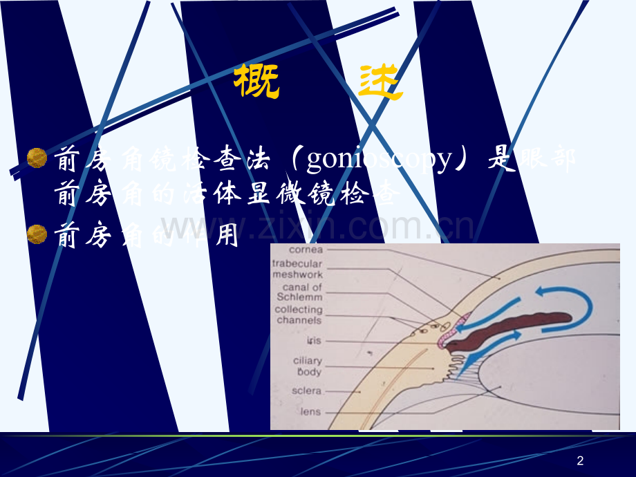 前房角镜检查法及其在眼科的应用.ppt_第2页