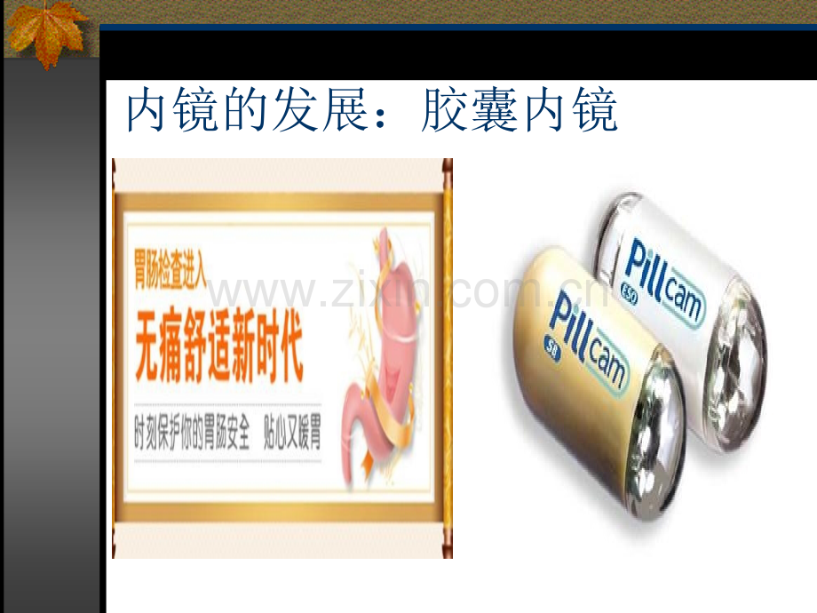 胶囊内镜PPT.ppt_第2页