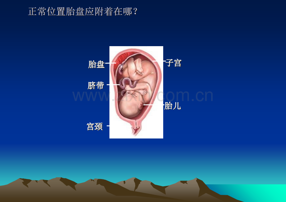 前置胎盘教学查房讲解PPT优质课件.ppt_第3页