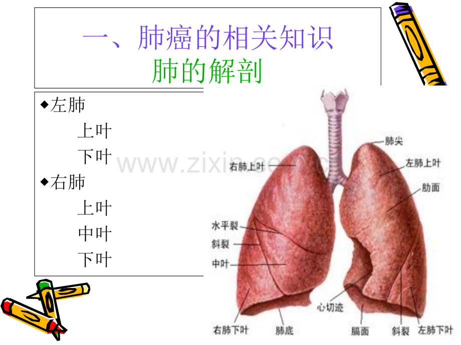 PPT医学课件肺癌的护理查房讲义.ppt_第2页