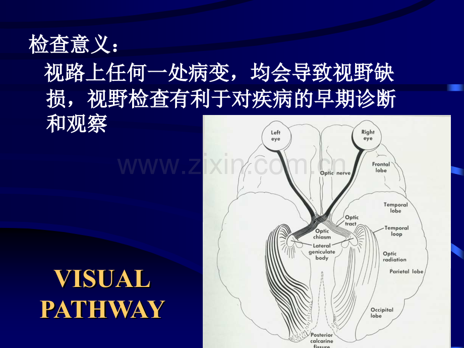 PPT医学课件视野缺损及相对应疾病讲义.ppt_第2页