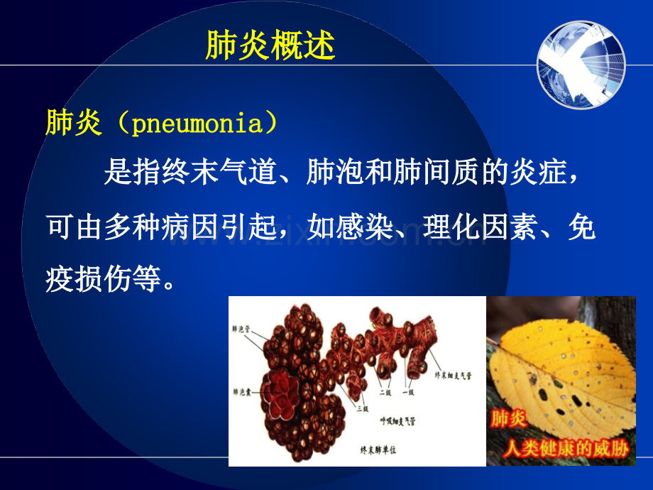 PPT医学课件肺炎病人的护理专业知识讲座讲义.ppt_第2页