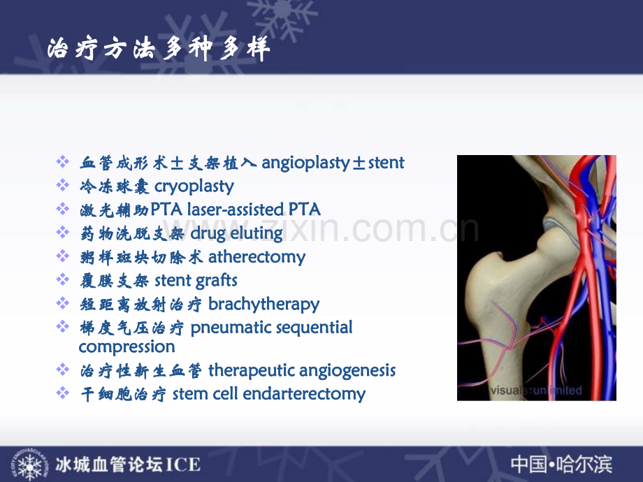 股浅动脉的介入治疗及循证医学证据.ppt_第3页