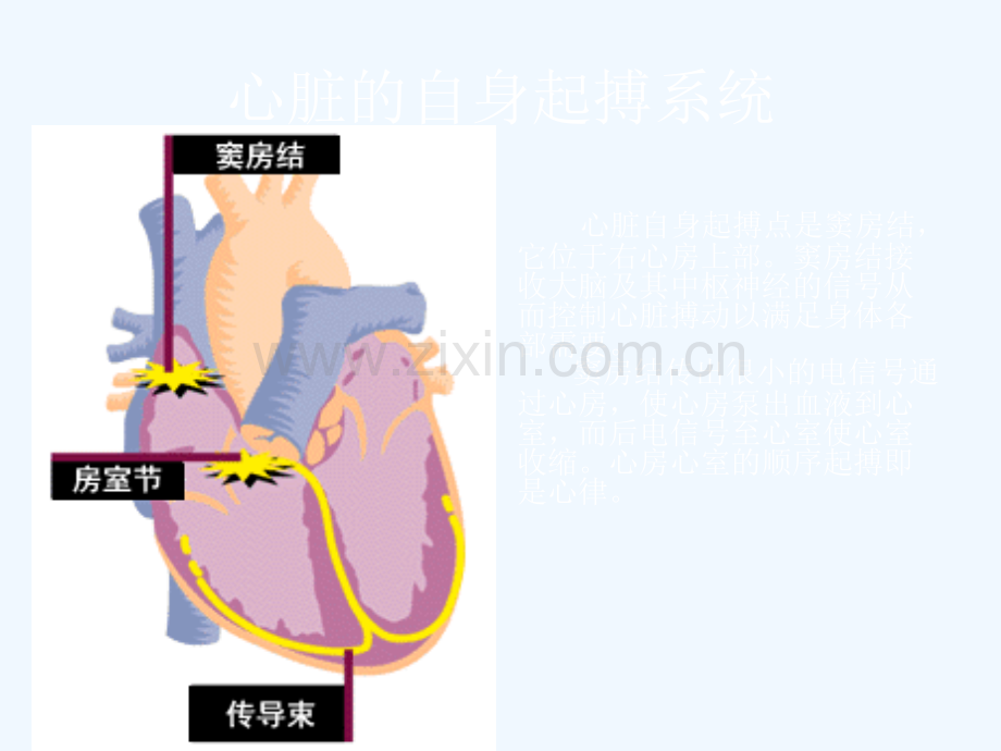 人工心脏起搏器护理与健康指导.ppt_第3页