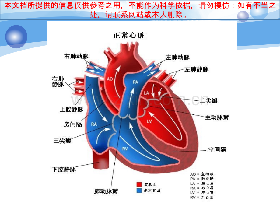 主动脉疾病手术简介培训课件.ppt_第3页