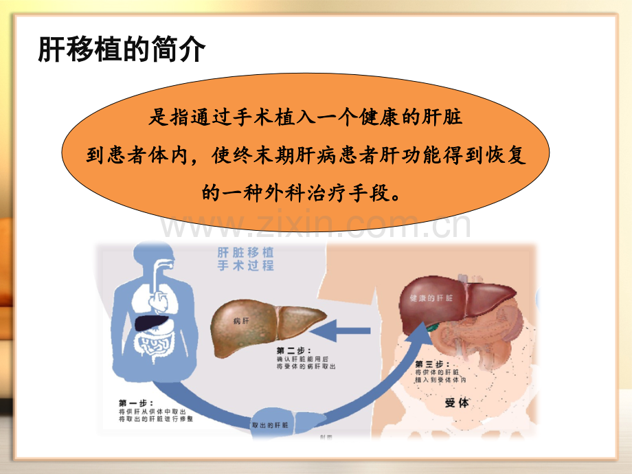 肝移植术后患者家庭护理.ppt_第3页