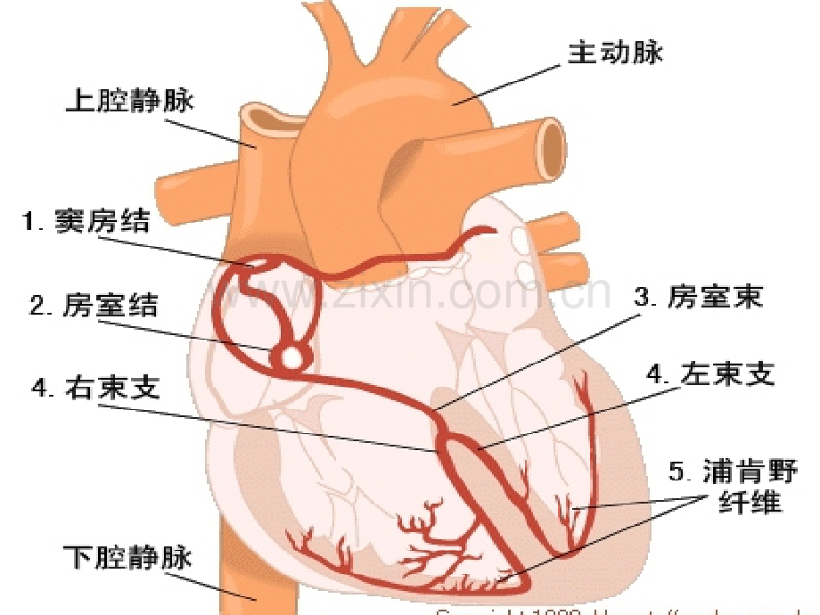 临床常见心律失常心电图波形.ppt_第3页