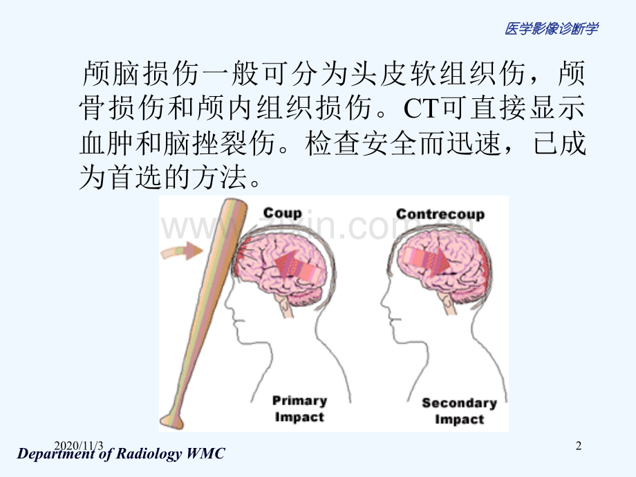 医学影像诊断学颅脑篇.ppt_第2页