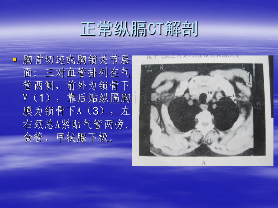 PPT医学课件胸部正常横断面解剖讲义.ppt_第2页