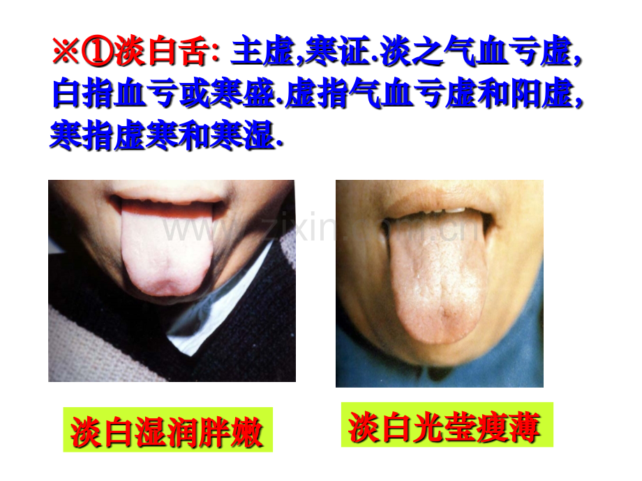 中医诊疗学舌诊图谱讲义.ppt_第3页