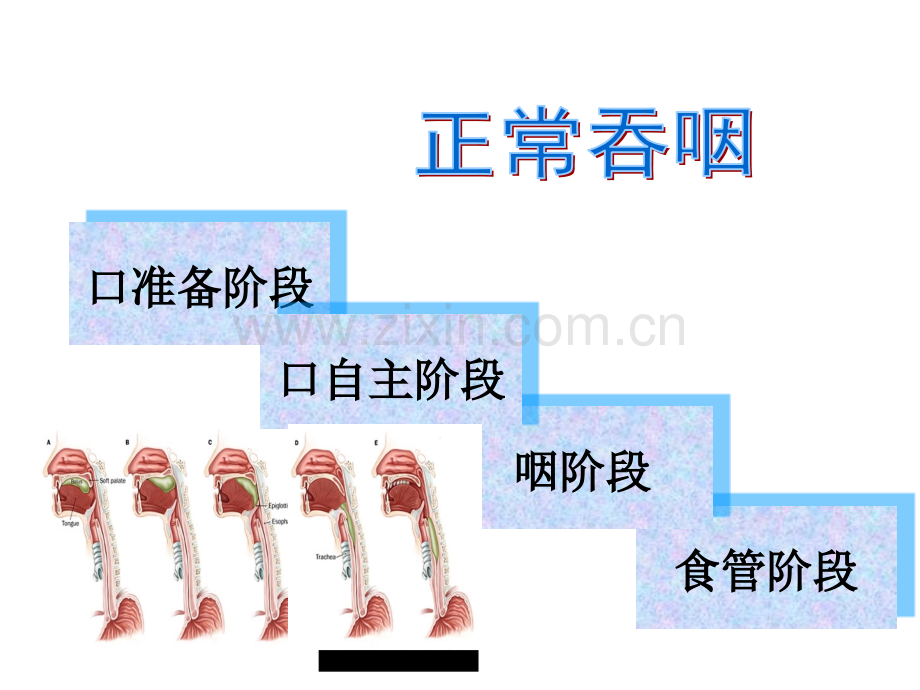 吞咽困难管理课件.pptx_第3页