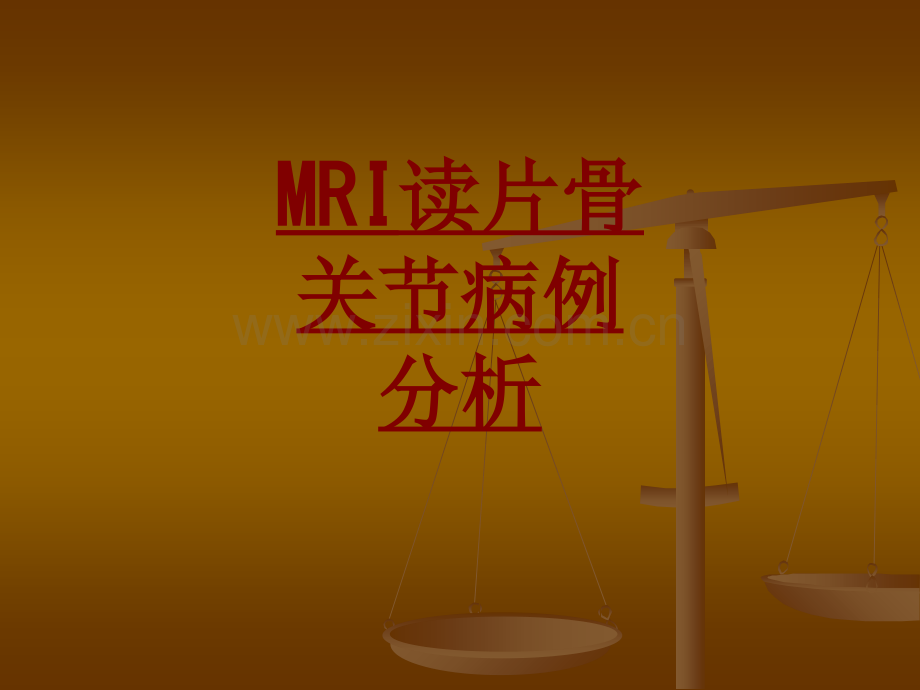 医学MRI读片骨关节病例分析专题课件.ppt_第1页