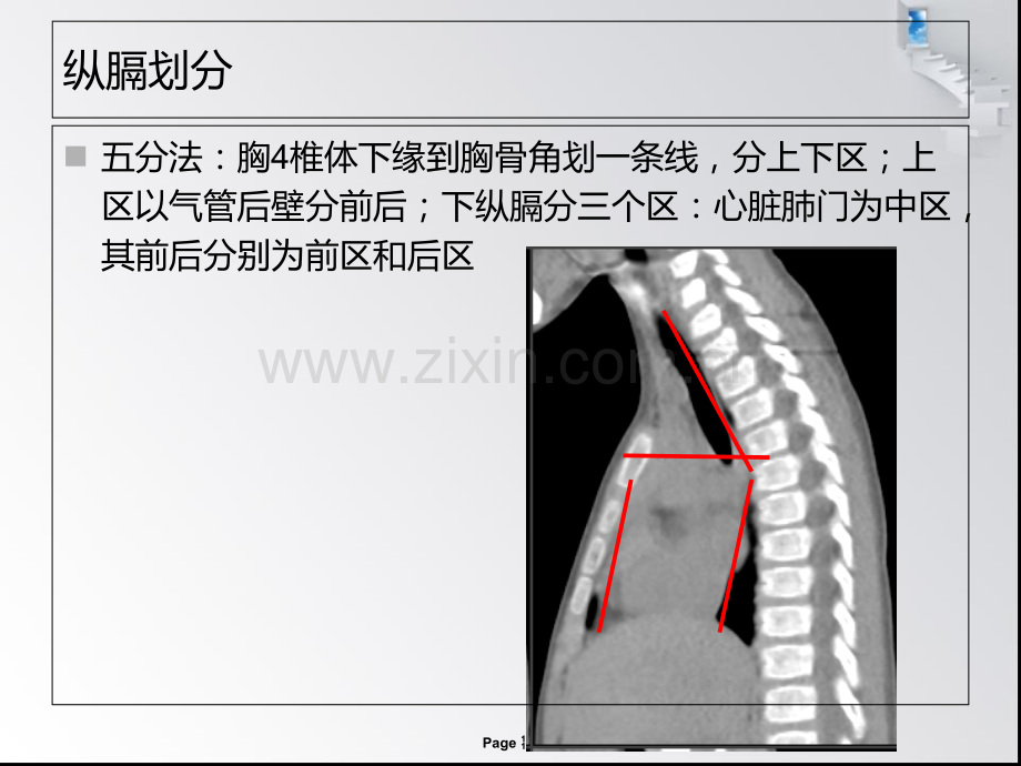 医学中后纵膈疾病诊疗PPT培训课件.ppt_第3页