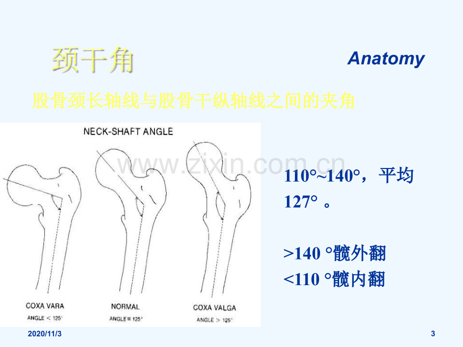 股骨颈骨折朱.ppt_第3页