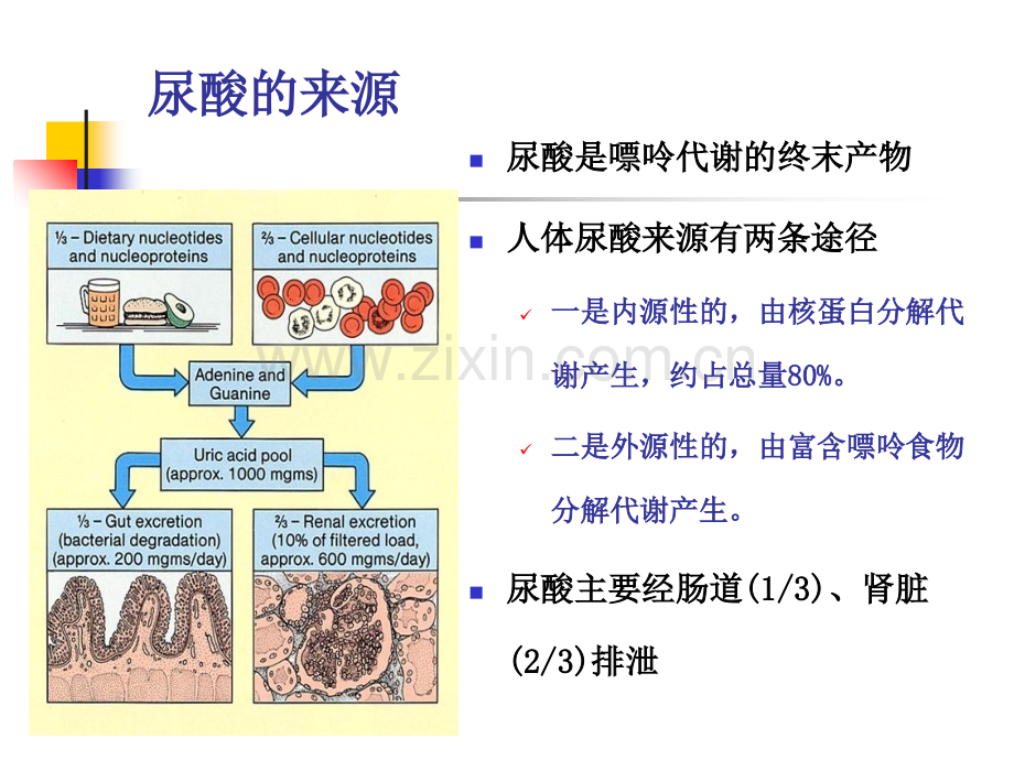 痛风性肾病护理查房.ppt_第2页