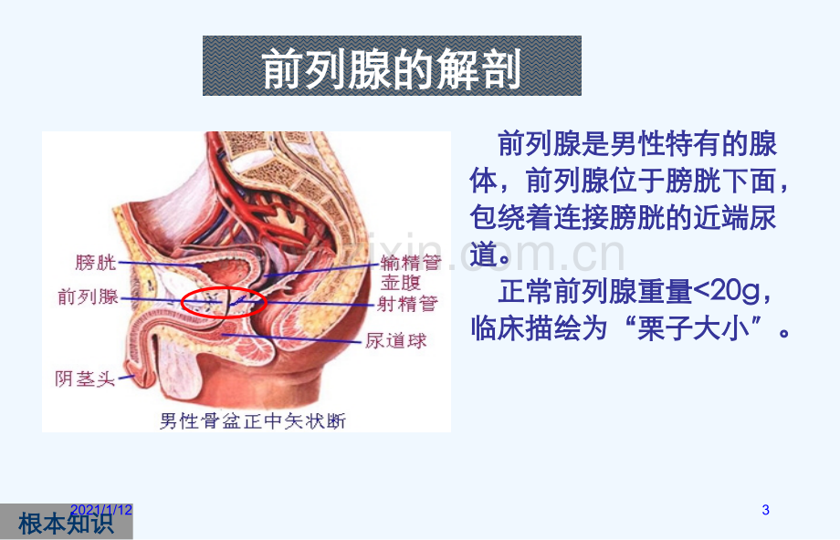 前列腺炎症及增生症.ppt_第3页