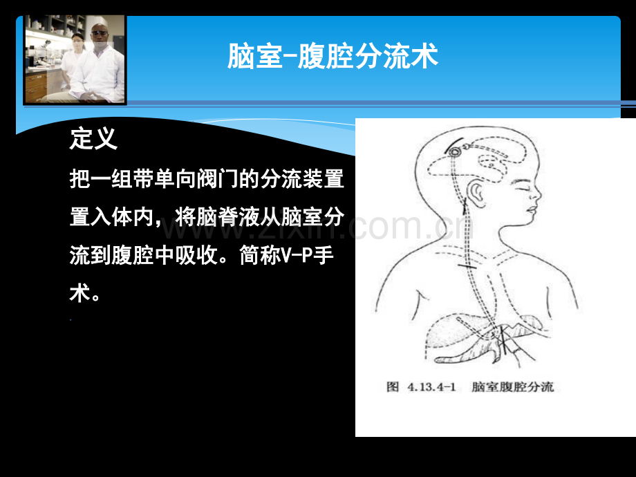 脑室腹腔分流术护理查房.ppt_第3页