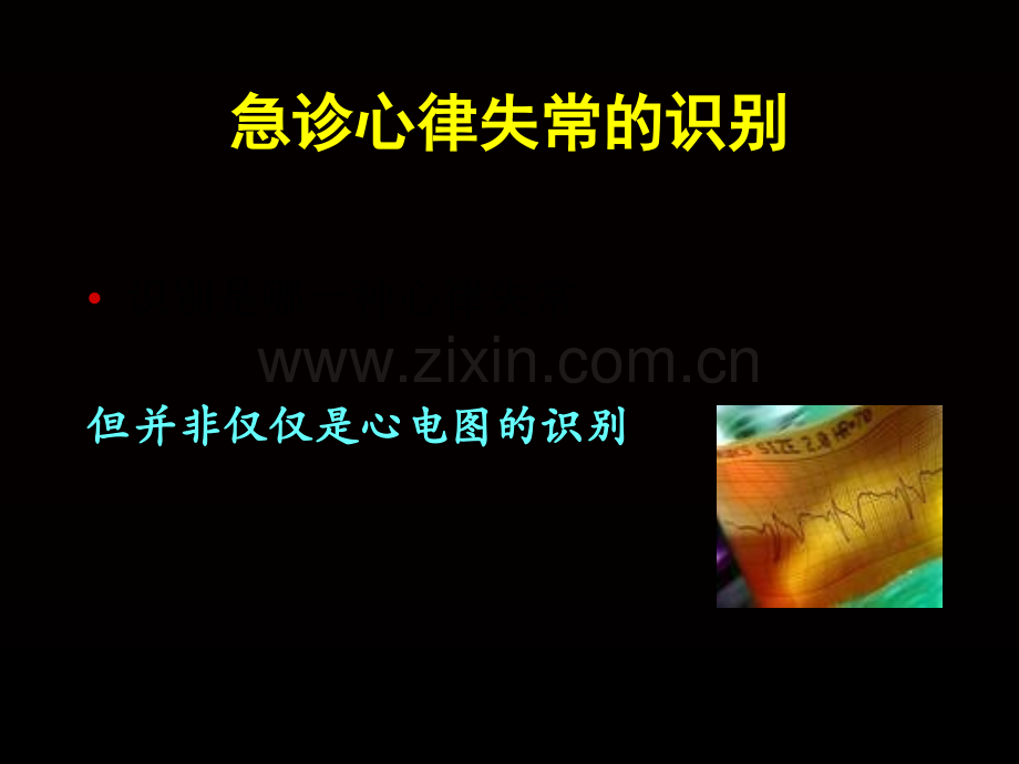 急诊室如何处理心律失常研究生课.ppt_第2页