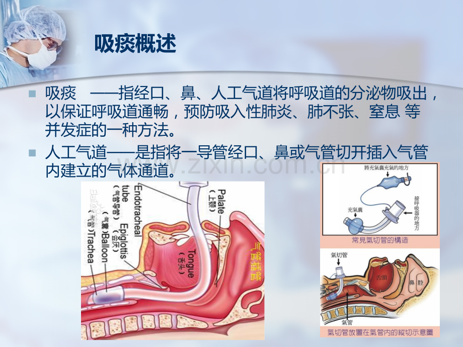 气管插管吸痰术.ppt_第2页