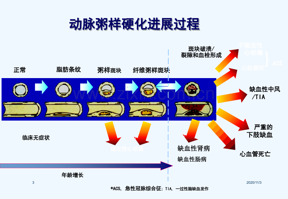 心绞痛口腔临床疾病.ppt_第3页