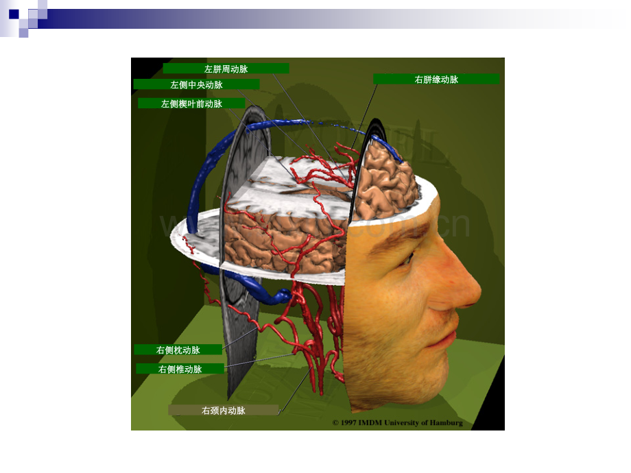 大脑血管解剖.ppt_第1页