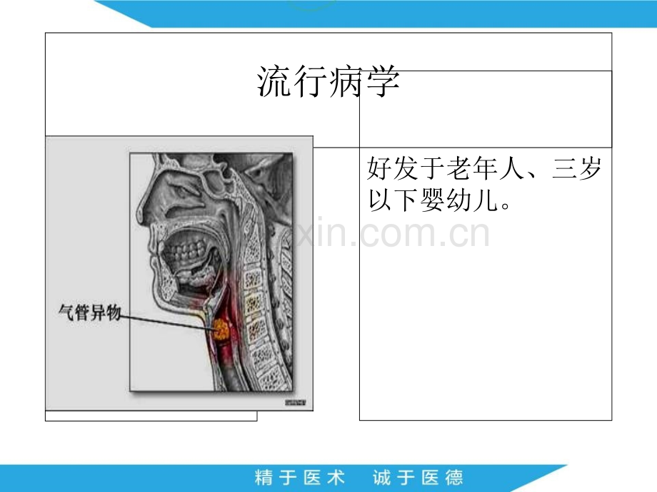 气管内异物的现场急救技术.ppt_第2页