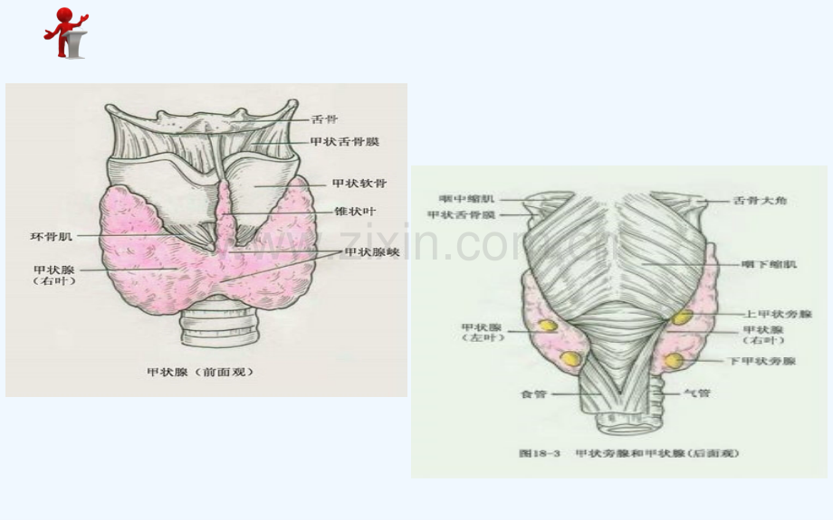 甲状腺功能亢进外科治疗病人的护理.ppt_第3页