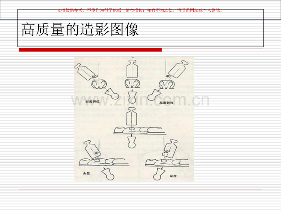 冠状动脉造影定量和定性分析课件.ppt_第3页