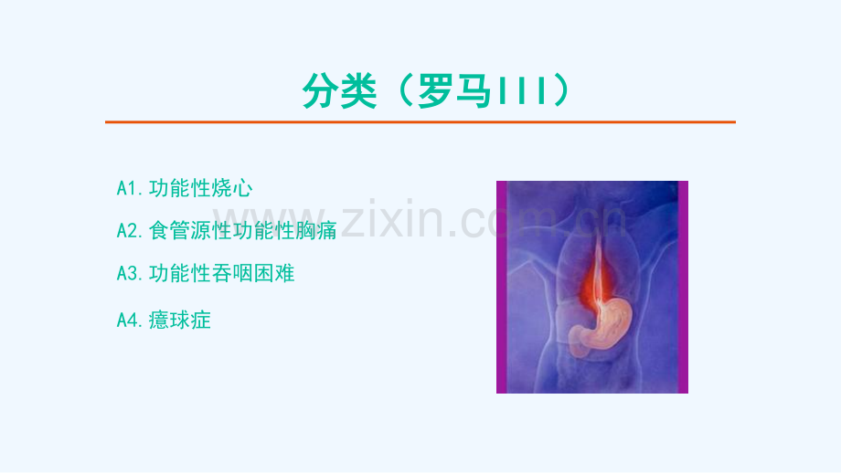 功能性食管疾病.pptx_第3页