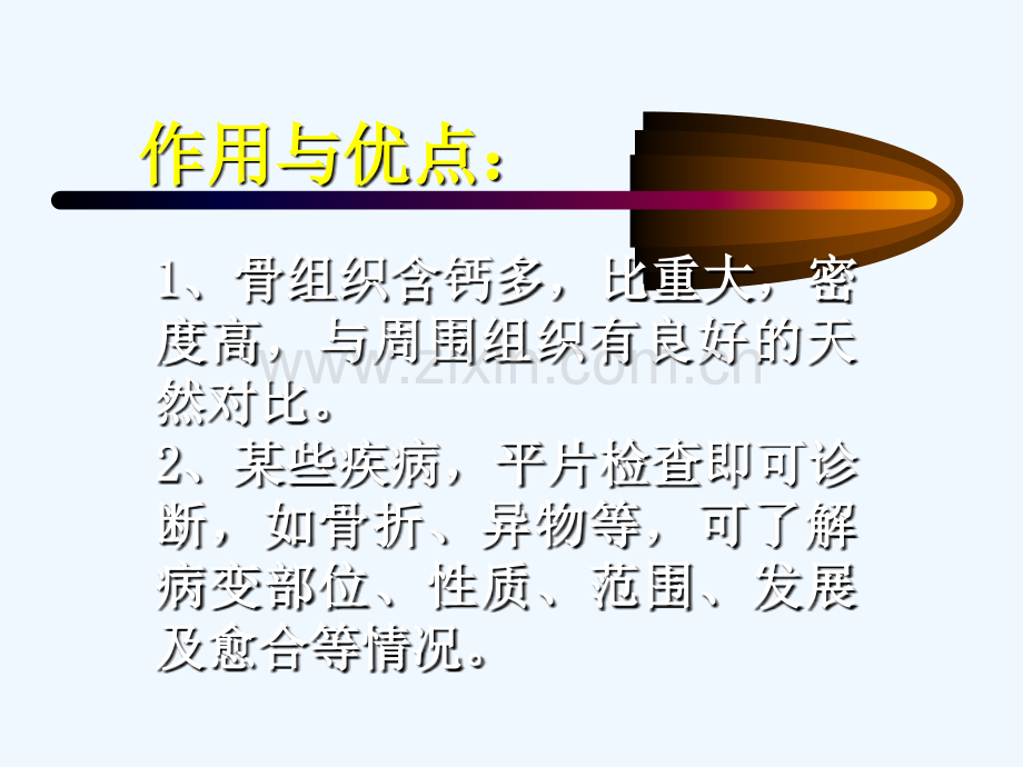 骨与关节X线诊断.ppt_第2页