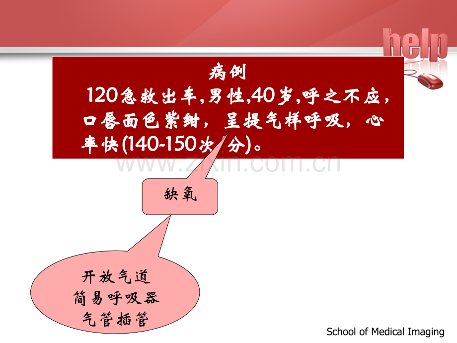 气管插管的医护配合.ppt_第2页