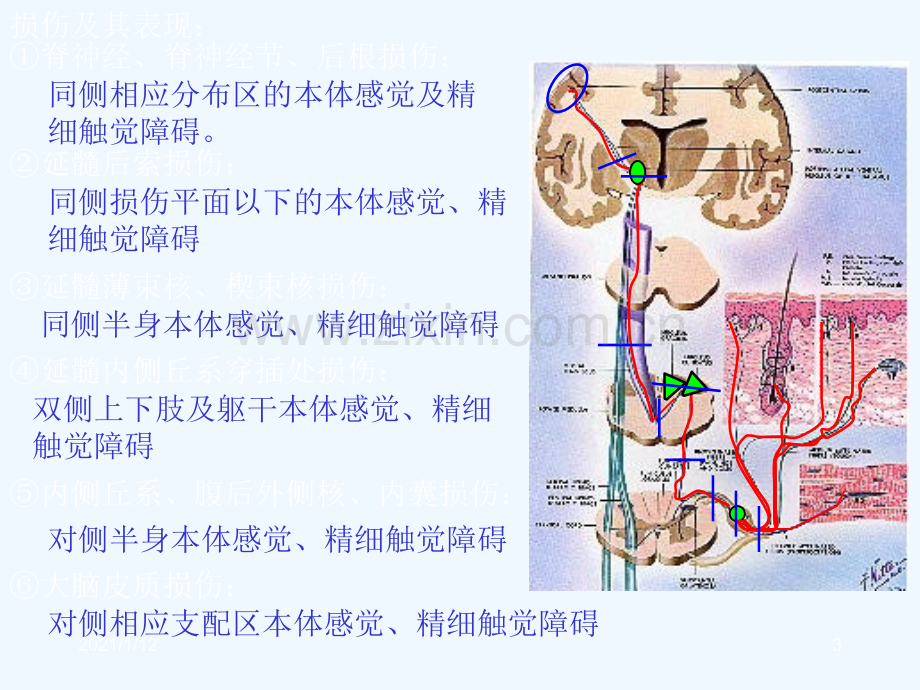 人体解剖之脑和脊髓的传导通路.ppt_第3页