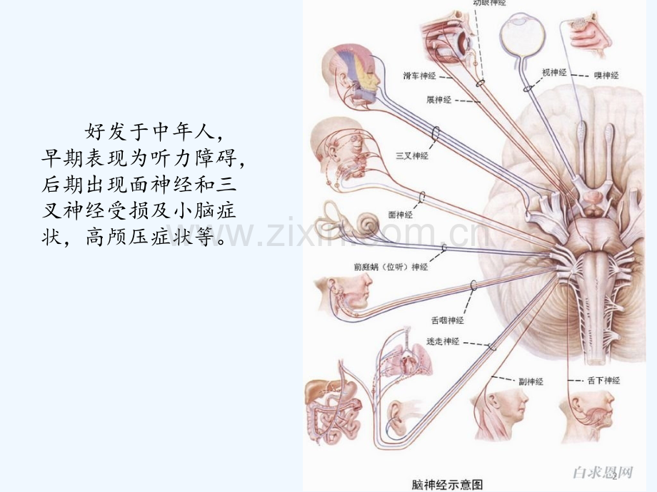 颅脑损伤MRI大全.ppt_第2页