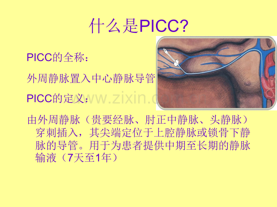 PICC置管术相关知识-医学课件.ppt_第1页