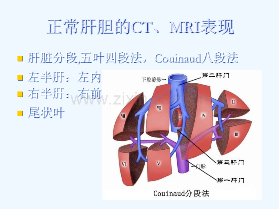 肝脏常见原发肿瘤的CTMRI表现.ppt_第3页