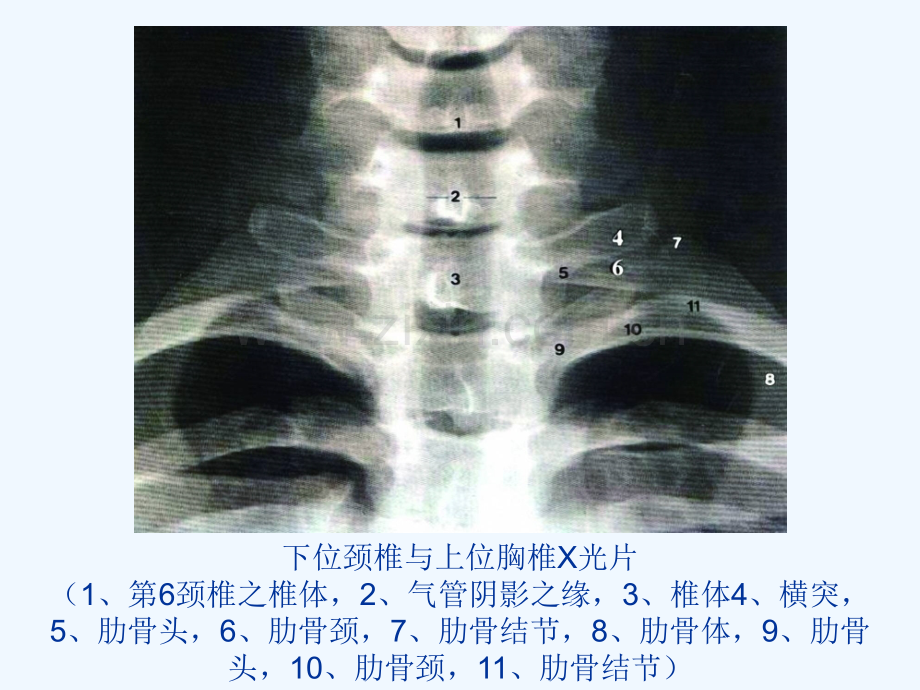 脊柱的影像学诊断.ppt_第3页