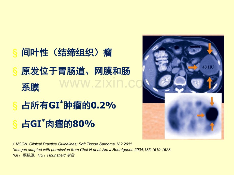 PPT医学课件胃肠道间质瘤GIST综合治疗经验分享讲义.ppt_第2页