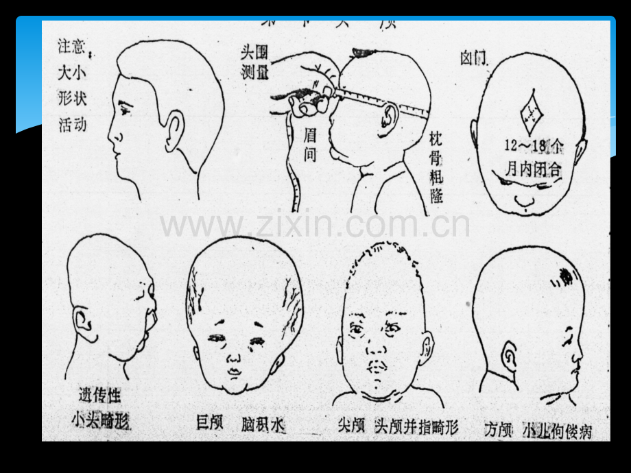 庾更绪诊断学头颈部检查.ppt_第3页