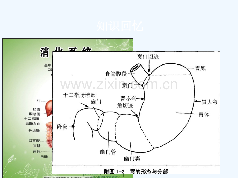 消化性溃疡的护理巫林茂.pptx_第2页