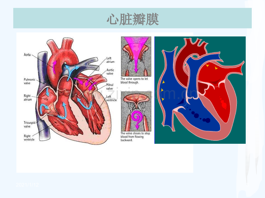 护理查房心脏瓣膜病.ppt_第3页