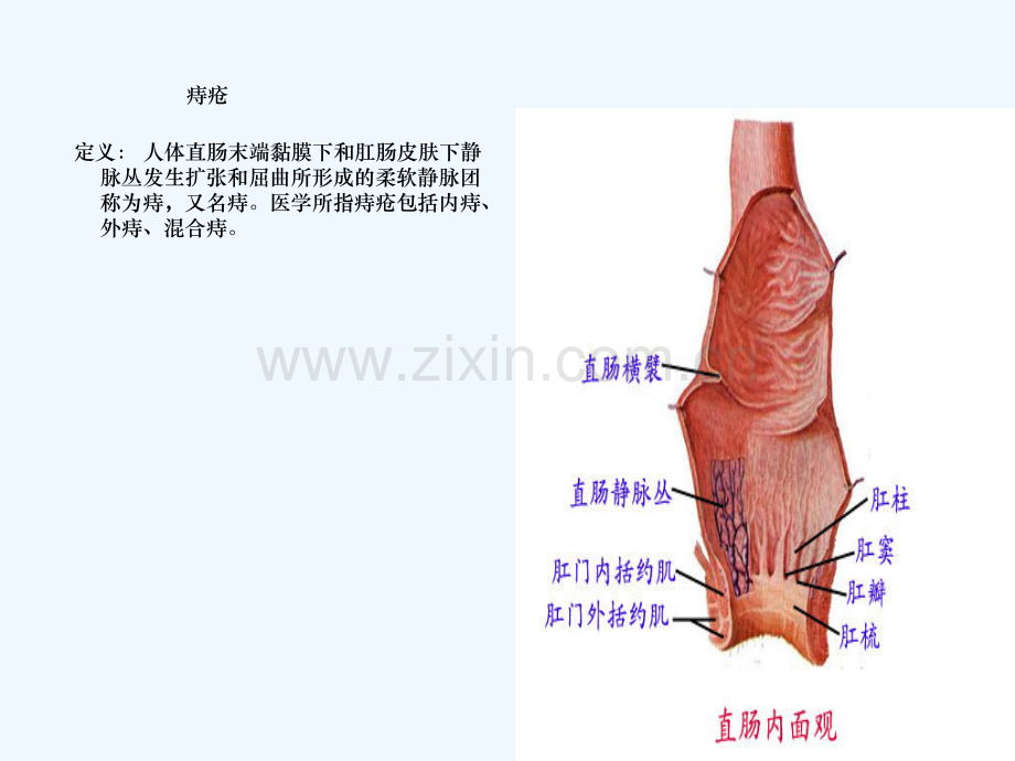 内痔术后预防便秘的护理.ppt_第3页