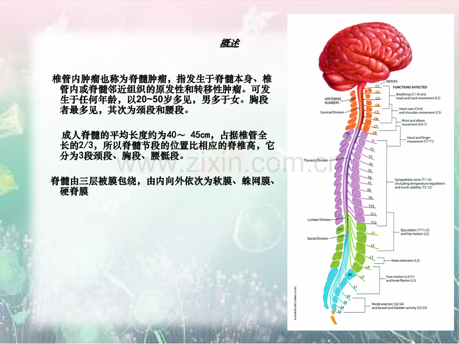 椎管内脊膜瘤的围手术期护理.ppt_第3页