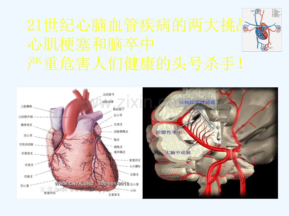 心血管疾病诊断、预防与治疗.ppt_第2页