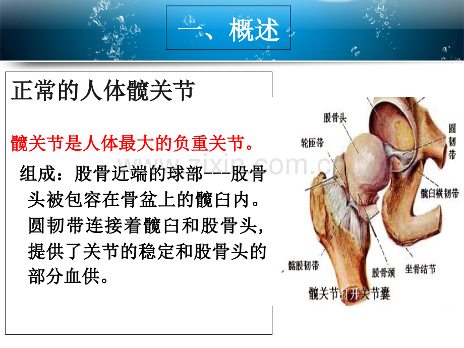 全髋关节置换术的教学查房PPT培训课件.ppt_第3页