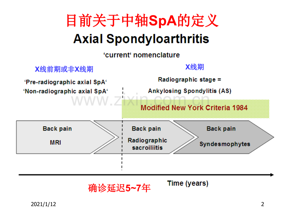 脊柱关节炎早期诊断新进展.ppt_第2页